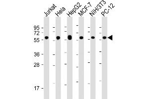 All lanes : Anti-Hsp60 Antibody at 1:16000 dilution Lane 1: Jurkat whole cell lysate Lane 2: Hela whole cell lysate Lane 3: HepG2 whole cell lysate Lane 4: MCF-7 whole cell lysate Lane 5: NIH/3T3 whole cell lysate Lane 6: PC-12 whole cell lysate Lysates/proteins at 20 μg per lane. (HSPD1 antibody  (AA 396-430))