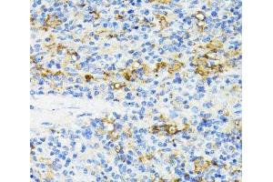 Immunohistochemistry of paraffin-embedded Rat spleen using CD27 Polyclonal Antibody at dilution of 1:100 (40x lens). (CD27 antibody)