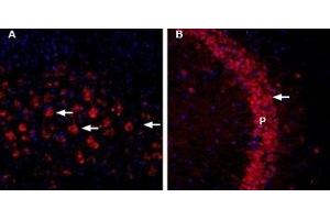 Expression of CHERP in mouse brain - Immunohistochemical staining of mouse cortex and hippocampus using Anti-CHERP-ATTO Fluor-594 Antibody (ABIN7043012).