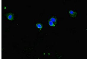 Immunofluorescent analysis of Hela cells using ABIN7148148 at dilution of 1:100 and Alexa Fluor 488-congugated AffiniPure Goat Anti-Rabbit IgG(H+L) (CCDC8 antibody  (AA 214-513))