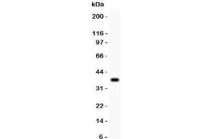Western blot testing of CYP2E1 antibody and recombinant human protein (0.