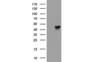 HEK293T cells were transfected with the pCMV6-ENTRY control (Left lane) or pCMV6-ENTRY LRRC25 (Right lane) cDNA for 48 hrs and lysed. (LRRC25 antibody)