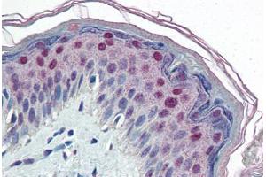 Human Skin (formalin-fixed, paraffin-embedded) stained with CEBPB antibody ABIN364320 at 10 ug/ml followed by biotinylated anti-mouse IgG secondary antibody ABIN481714, alkaline phosphatase-streptavidin and chromogen. (CEBPB antibody)