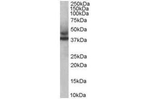 Image no. 1 for anti-Tripartite Motif Containing 54 (TRIM54) (C-Term) antibody (ABIN374312) (TRIM54 antibody  (C-Term))