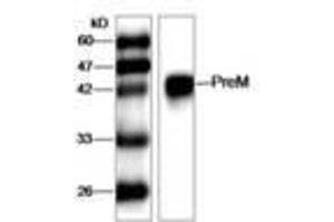 Image no. 1 for anti-West Nile Virus (WNV) (AA 1-135) antibody (ABIN791626) (West Nile Virus antibody  (AA 1-135))