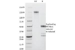 SDS-PAGE Analysis Purified CD44 Mouse Monoclonal Antibody (DF1485). (CD44 antibody)