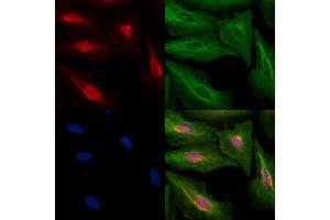ABIN6259270 and ABIN6274431 staining  cells by IF/ICC. (PPHLN1 antibody  (N-Term))