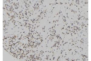 ABIN6267108 at 1/100 staining Human gastric tissue by IHC-P. (Cyclin E1 antibody  (pThr77))