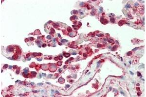 Human Lung: Formalin-Fixed, Paraffin-Embedded (FFPE) (Cofilin antibody  (AA 4-32))