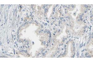Immunohistochemistry (IHC) image for anti-Annexin A5 (ANXA5) (C-Term) antibody (ABIN6259956)