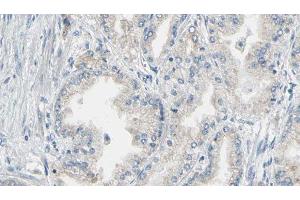 ABIN6276843 at 1/100 staining Human prostate tissue by IHC-P. (Annexin V antibody  (C-Term))