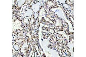 IHC analysis of FTO using anti-FTO antibody (ABIN7601059).
