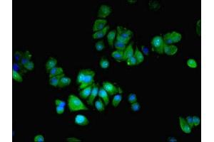 Immunofluorescent analysis of MCF-7 cells using ABIN7159082 at dilution of 1:100 and Alexa Fluor 488-congugated AffiniPure Goat Anti-Rabbit IgG(H+L) (MLX antibody  (AA 1-244))
