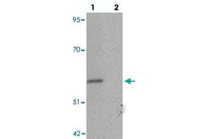 Western blot analysis of ESRRB in human heart tissue with ESRRB polyclonal antibody  at 1 ug/mL in (1) the absence and (2) the presence of blocking peptide. (ESRRB antibody  (C-Term))