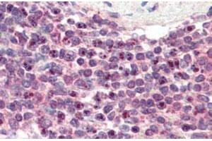 NR1H2 polyclonal antibody  (3 ug/mL) staining of paraffin embedded human spleen. (NR1H2 antibody)