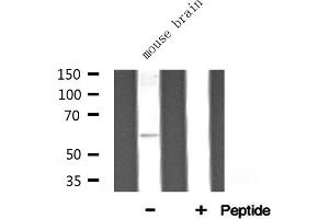 Western blot analysis of ATP5A1 expression in Mouse brain lysate (ATP5A1 antibody  (Internal Region))
