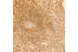 Immunoperoxidase of monoclonal antibody to AKAP13 on formalin-fixed paraffin-embedded human spleen. (AKAP13 antibody  (AA 1-110))