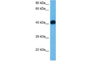 Host:  Mouse  Target Name:  NFKBIB  Sample Tissue:  Mouse Heart  Antibody Dilution:  1ug/ml (NFKBIB antibody  (N-Term))