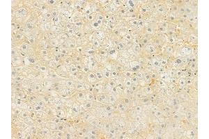 ABIN6262011 and ABIN6277630 at 1/100 staining human normal liver tissue by IHC-P. (GNAS antibody  (C-Term))