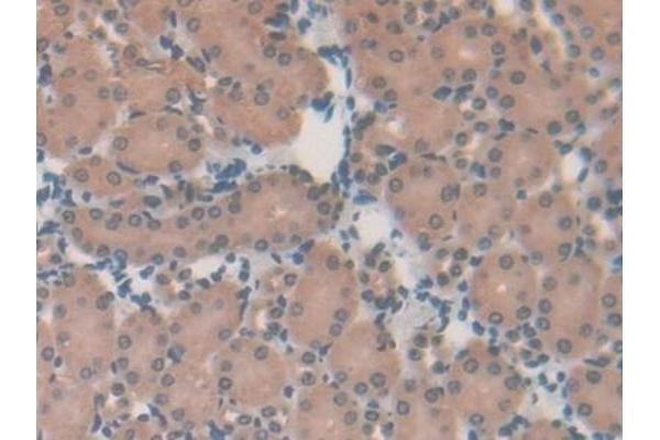 CS antibody  (AA 174-428)