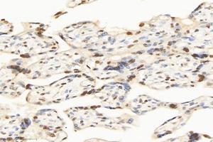 Immunohistochemistry analysis of paraffin-embedded human placenta using,SET (ABIN7075583) at dilution of 1: 10000 (SET/TAF-I antibody)