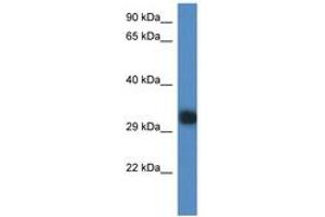 Image no. 1 for anti-Predicted Gene 527 (GM527) (AA 218-267) antibody (ABIN6746331) (GM527 antibody  (AA 218-267))