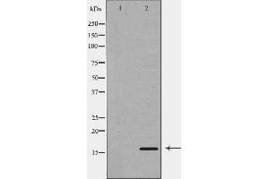 PLA2G2A antibody  (Internal Region)
