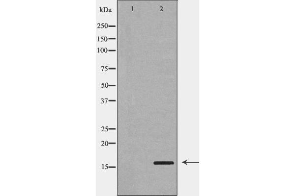 PLA2G2A antibody  (Internal Region)