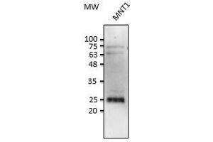 Anti-Rab38 Ab at 1/2,500 dilution, Iysates at 50 µg per Iane, rabbit polyclonal to goat (HRP) at 1/10,000 dilution, (RAB38 antibody  (C-Term))