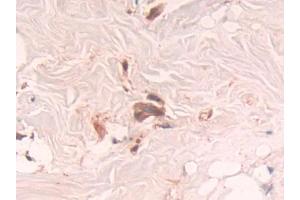 Used in DAB staining on fromalin fixed paraffin-embedded Brain tissue (RNASET2 antibody  (AA 25-256))