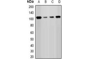 Western blot analysis of PHC1 expression in Hela (A), Jurkat (B), A549 (C), mouse kidney (D) whole cell lysates. (PHC1 antibody)