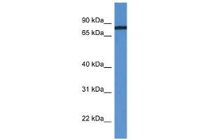 WB Suggested Anti-HHIPL1 Antibody Titration: 0. (HHIPL1 antibody  (C-Term))