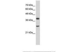 Image no. 1 for anti-Cytosolic Iron-Sulfur Protein Assembly 1 (CIAO1) (AA 247-296) antibody (ABIN203313) (CIAO1 antibody  (AA 247-296))