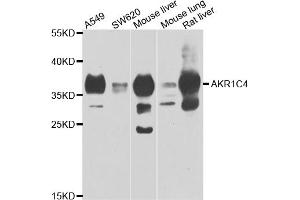 Western blot analysis of extracts of various cell lines, using AKR1C4 antibody (ABIN5975529) at 1/1000 dilution. (AKR1C4 antibody)