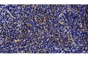 Detection of TLR5 in Rat Spleen Tissue using Polyclonal Antibody to Toll Like Receptor 5 (TLR5) (TLR5 antibody  (AA 325-644))