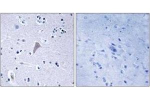 Immunohistochemistry analysis of paraffin-embedded human brain tissue, using mTOR (Ab-2448) Antibody. (MTOR antibody  (AA 2415-2464))