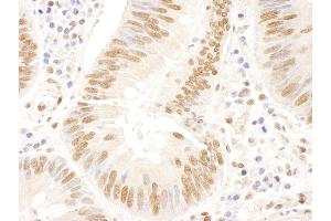 anti-Fanconi Anemia, Complementation Group D2 (FANCD2) (AA 1401-1451) antibody