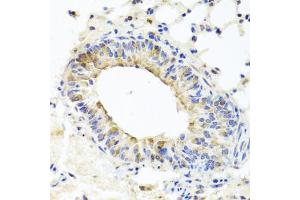 Immunohistochemistry of paraffin-embedded mouse lung using MUC16 antibody (ABIN6003713) at dilution of 1/100 (40x lens). (MUC16 antibody)