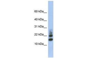 Image no. 1 for anti-Ribosomal Protein S15a (RA) (AA 71-120) antibody (ABIN6744019) (RPS15A antibody  (AA 71-120))
