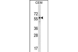 DPH2 Antibody (N-term) (ABIN1538986 and ABIN2849764) western blot analysis in CEM cell line lysates (35 μg/lane). (DPH2 antibody  (N-Term))