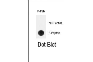 Dot Blot (DB) image for anti-Telomerase Reverse Transcriptase (TERT) (pTyr707) antibody (ABIN3001892) (TERT antibody  (pTyr707))