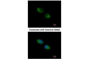 ICC/IF Image Immunofluorescence analysis of methanol-fixed HeLa, using TXNDC1, antibody at 1:500 dilution. (TMX1 antibody  (C-Term))