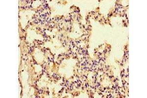 Immunohistochemistry of paraffin-embedded human lung tissue using ABIN7156789 at dilution of 1:100 (IL-13 antibody  (AA 30-125))