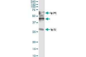 Immunoprecipitation (IP) image for anti-ADAM Metallopeptidase with Thrombospondin Type 1 Motif, 4 (ADAMTS4) (AA 1-339) antibody (ABIN948814)