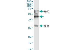 Immunoprecipitation of ADAMTS4 transfected lysate using anti-ADAMTS4 MaxPab rabbit polyclonal antibody and Protein A Magnetic Bead , and immunoblotted with ADAMTS4 MaxPab rabbit polyclonal antibody (D01) . (ADAMTS4 antibody  (AA 1-339))