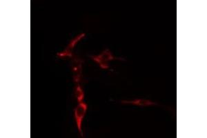 ABIN6276893 staining  COLO205 cells by IF/ICC. (Syndecan 2 antibody  (C-Term))
