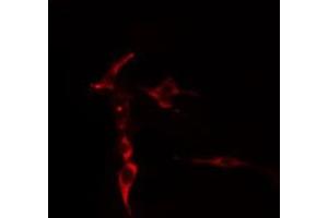 ABIN6276893 staining  COLO205 cells by IF/ICC.