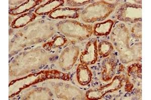 Immunohistochemistry of paraffin-embedded human kidney tissue using ABIN7149198 at dilution of 1:100 (CYP11B2 antibody  (AA 25-503))