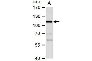 WB Image NBS1 antibody detects NBS1 protein by western blot analysis.