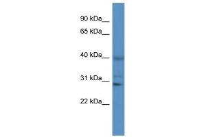 Western Blot showing CTSS antibody used at a concentration of 1 ug/ml against Jurkat Cell Lysate